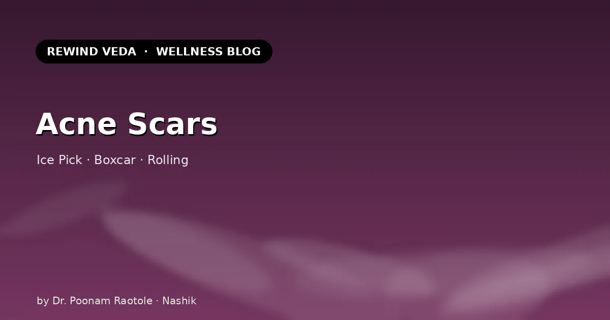 Acne Scars: Ice Pick, Boxcar & Rolling Scars — Treatment Options